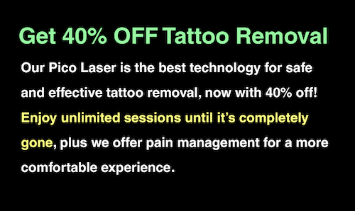 tattoo laser removal infoe